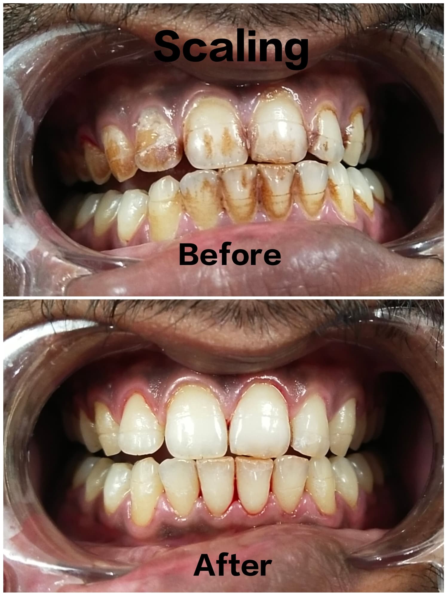 Professional Cleaning Results